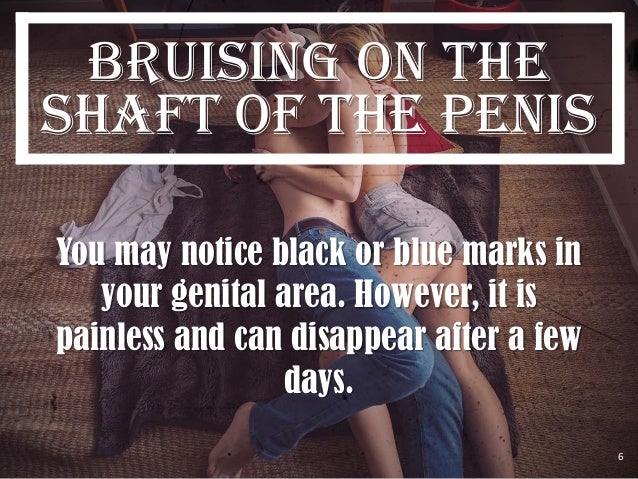 FREE FEMALE PORN PICTURES Get Biger Penis